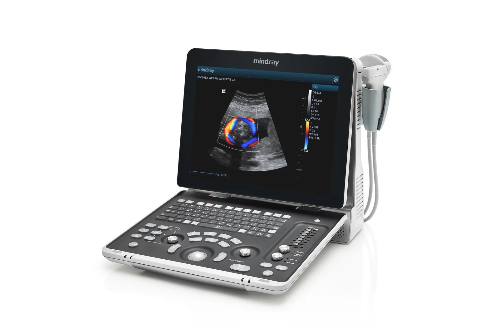 Mindray Z50 Vet Портативный УЗИ аппарат с цветным доплером — фото 3